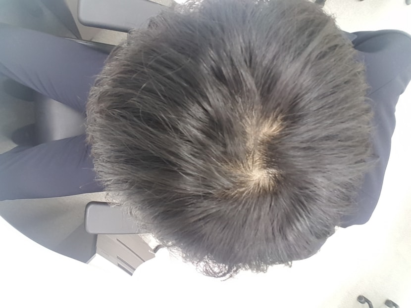 17.6.28 ,  가만히놔두면 잘보이진않지만...