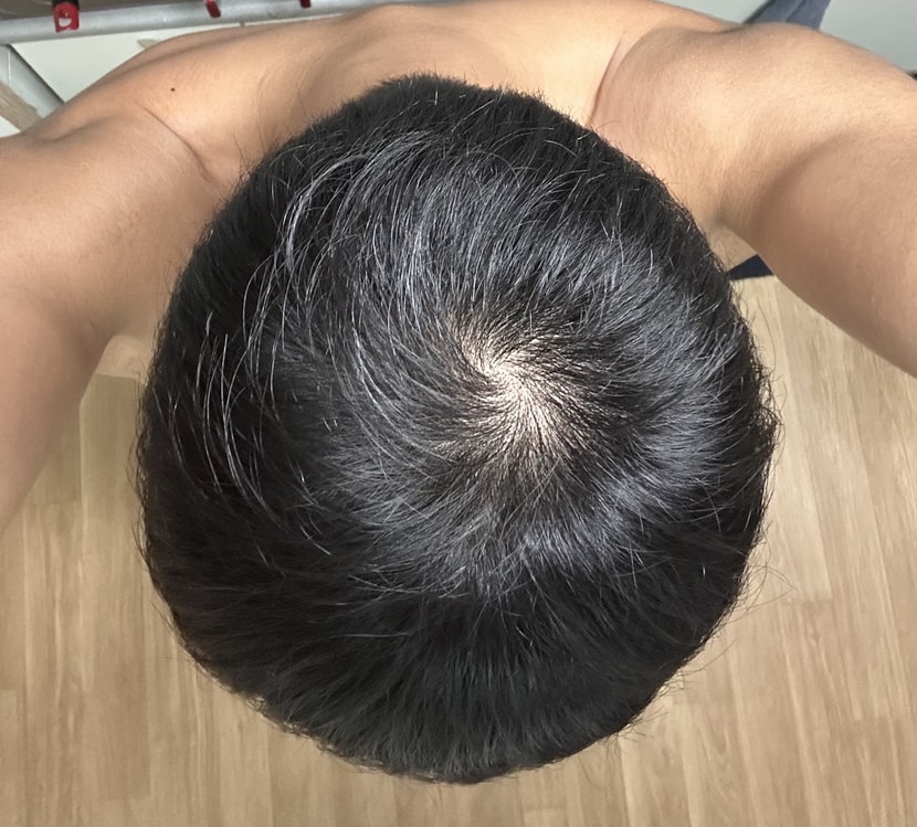머리 말린후 