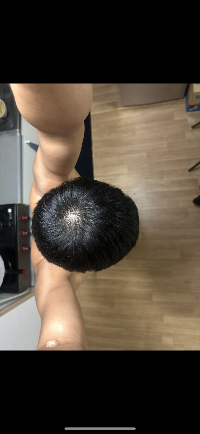 호전2