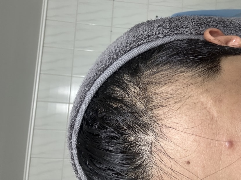 왼쪽 말리기전 