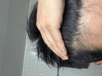 오른쪽 말린후 