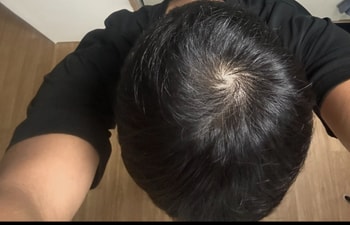 2달반차 살짝 호전 