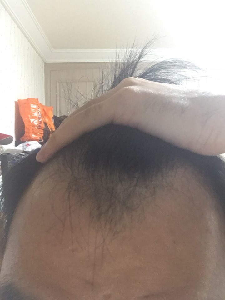 M자부분