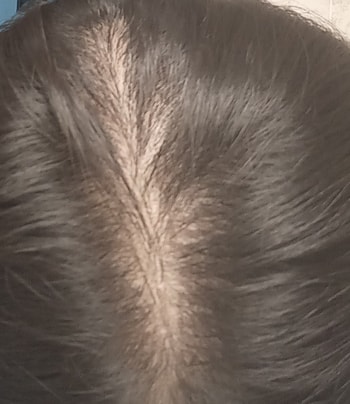 뒷머리는 뭘 해도 갈라지더라구요...헤어쿠션을 발라야되나..