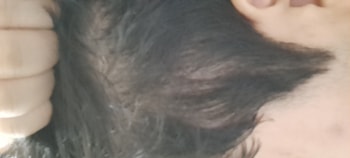 옆머리