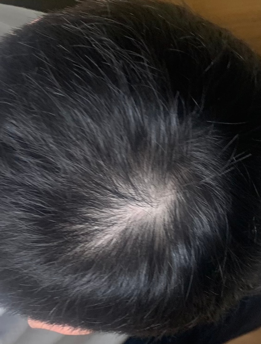 아침에 머리 말리고 찍은 사진