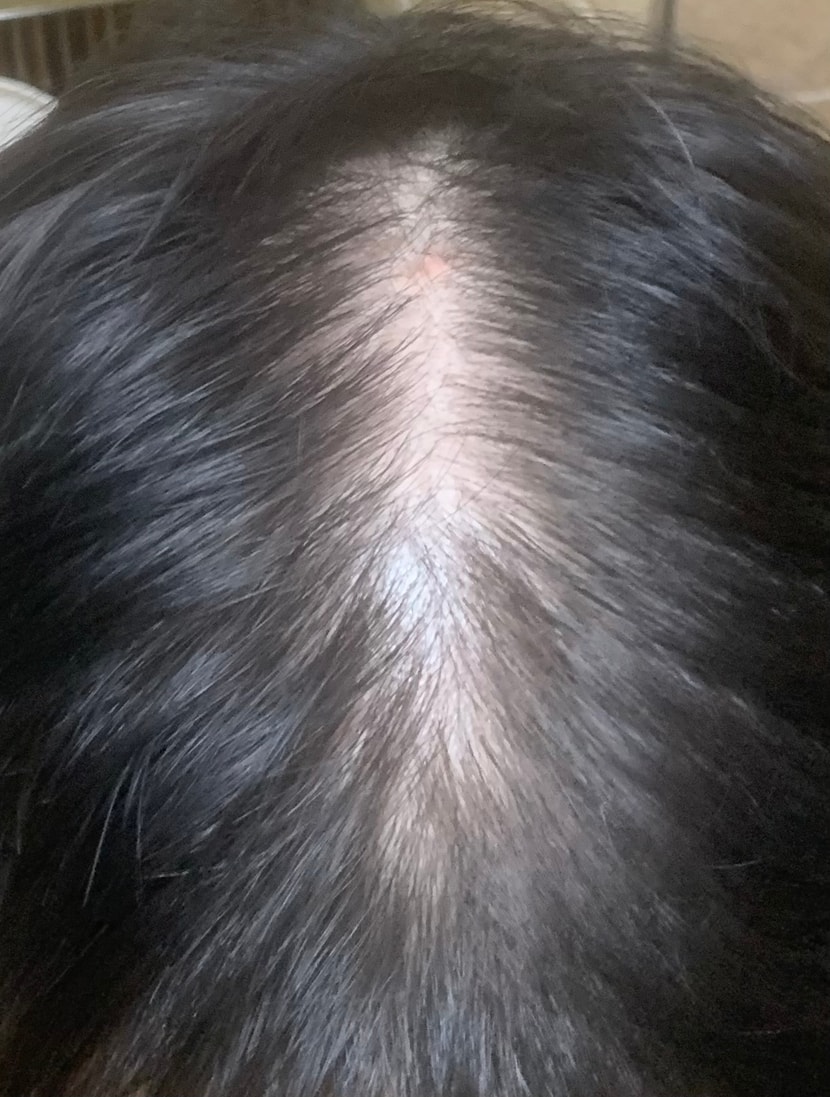 어제 저녁 자기전 찍은