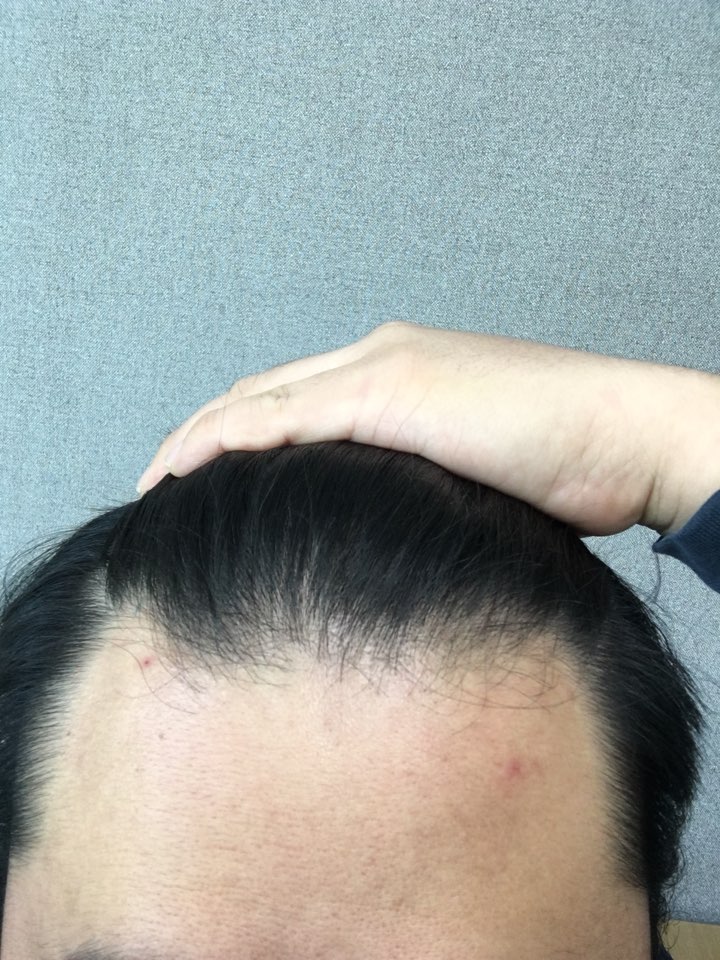 복용전 앞부분