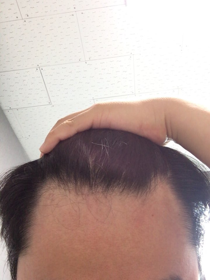 복용후 앞부분
