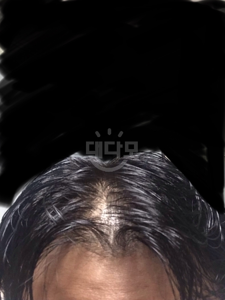 2개월 전사진