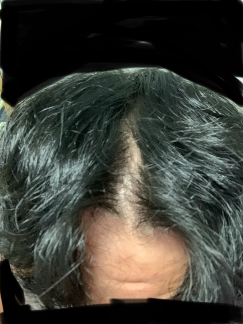 현재 사진