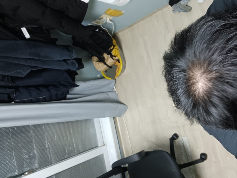 3월 미녹시딜 사용 당시입니다