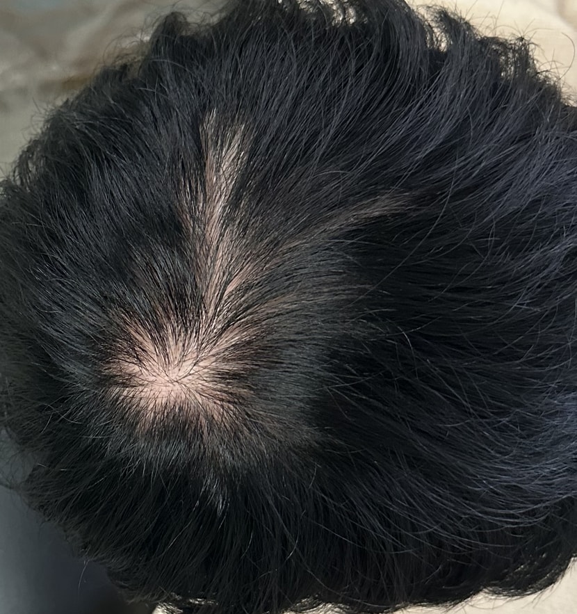 염색 후 1주 지난 사진