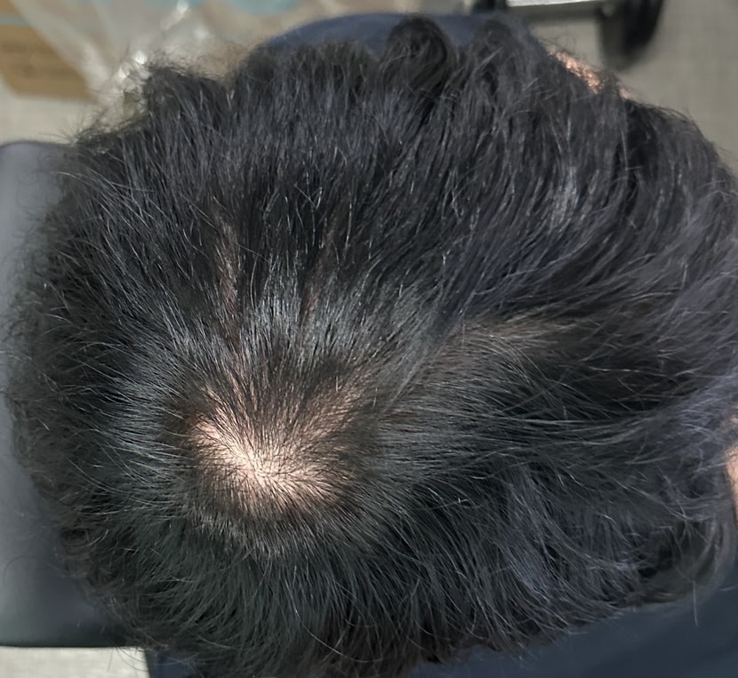 염색직후