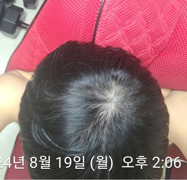 ㅁㄴㅇ