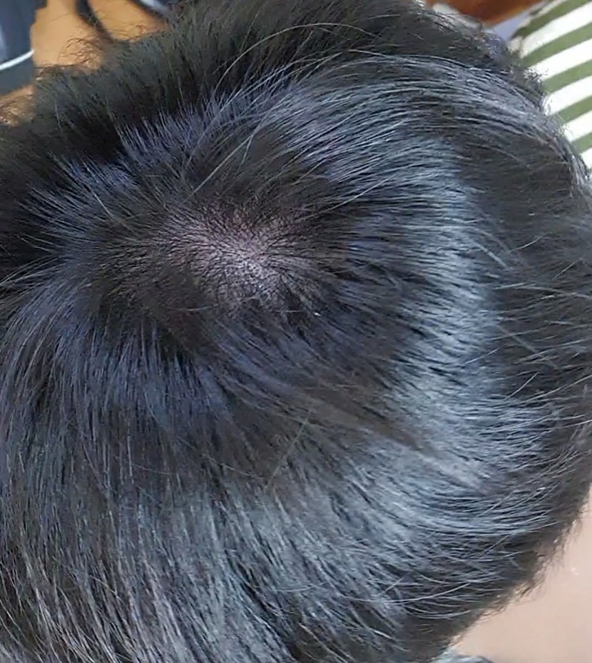 1년전 포즈1