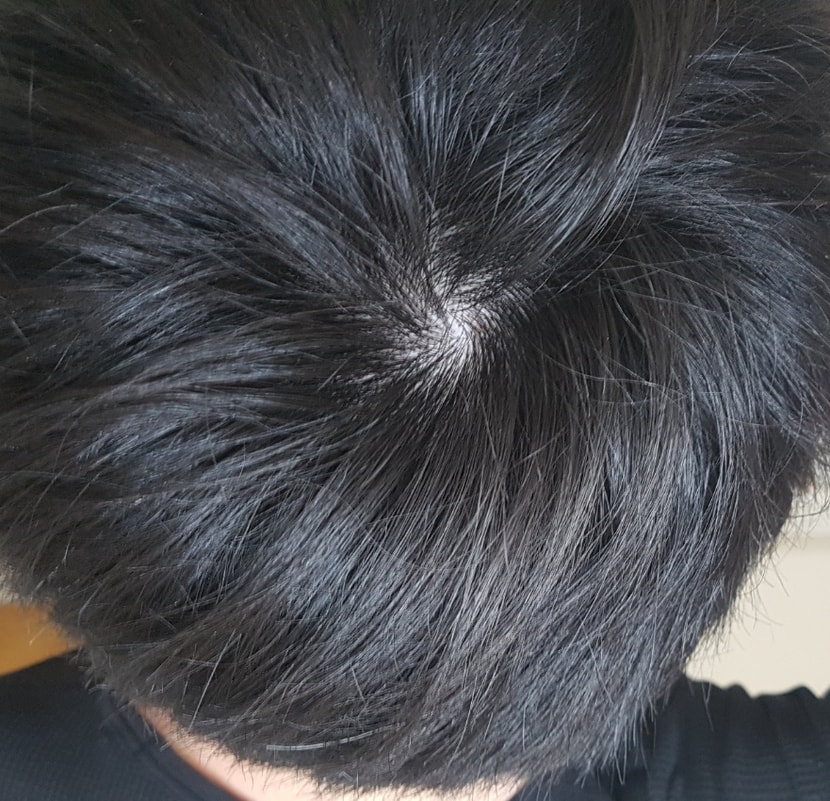 정수리 주변에도 갈색머리가 부분 부분 있음