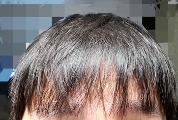 현재 앞머리