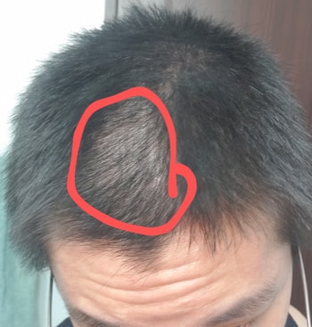 앞머리