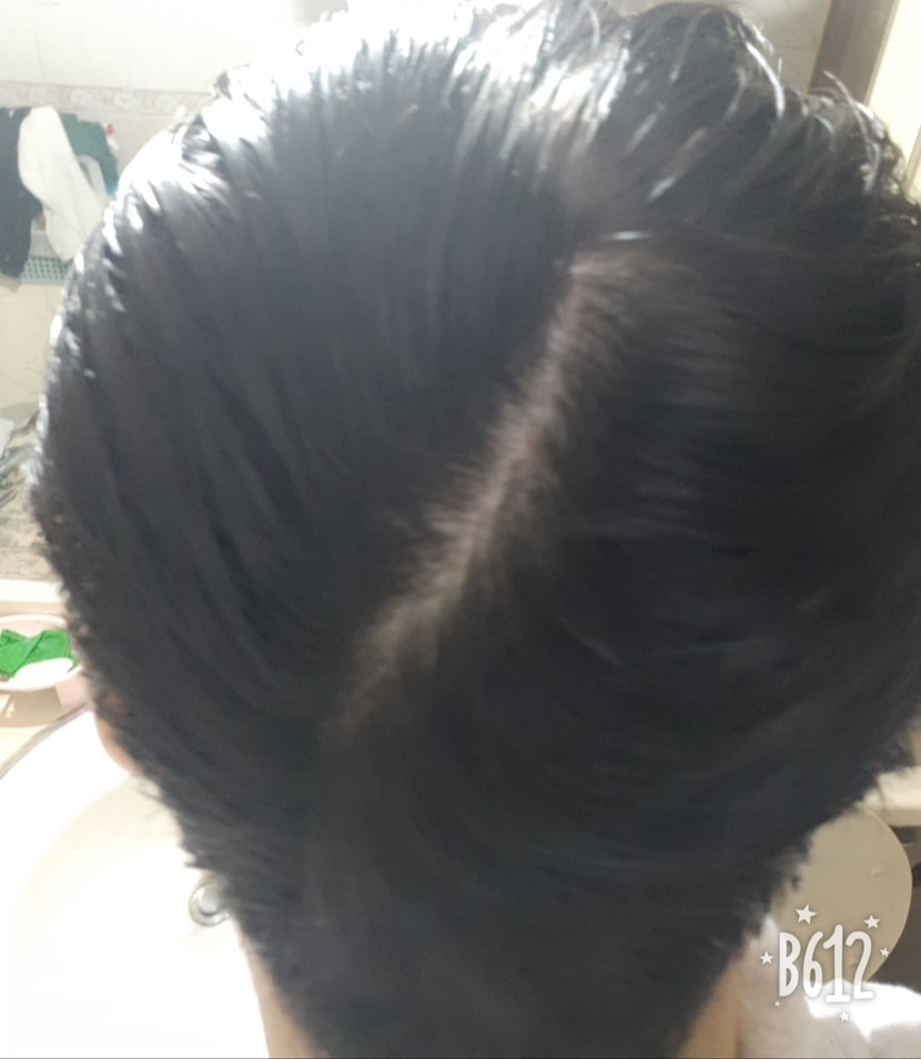 뒤통수