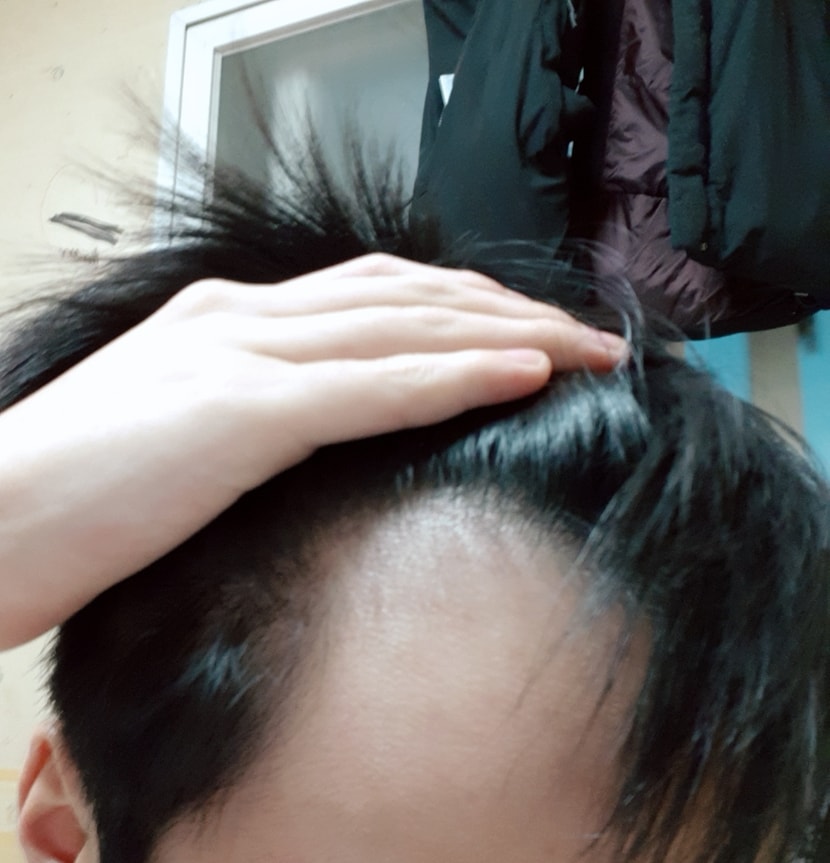 1년1개월전