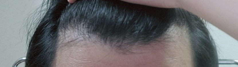 현재