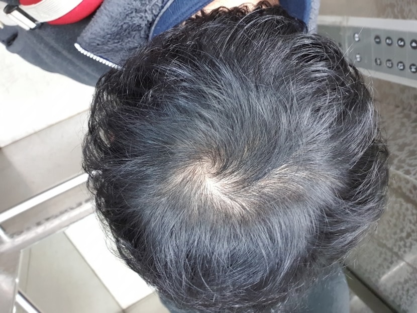 한달 째 입니다