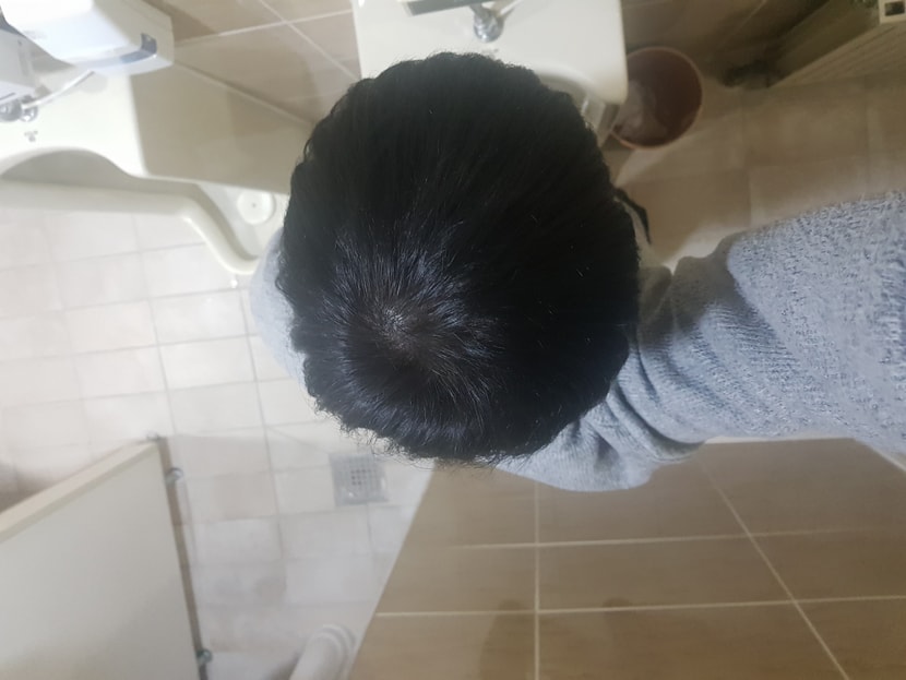 커버후