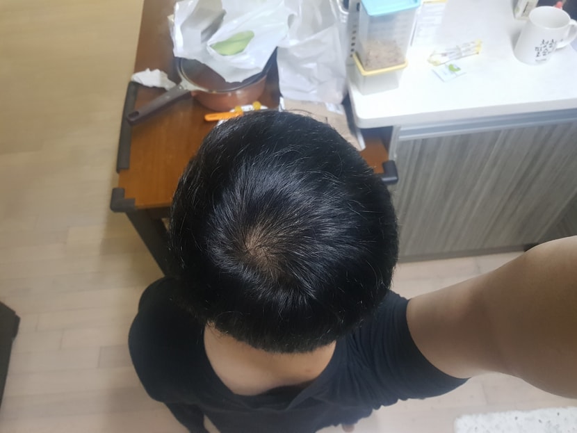 이틀전