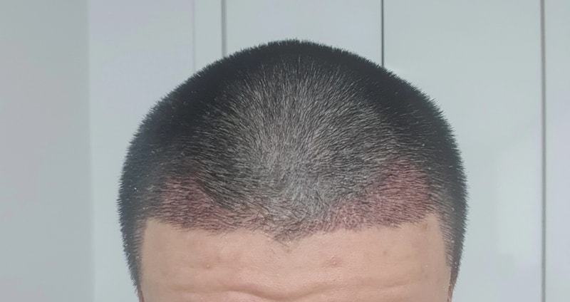 한...4년만이네요... 이 사이트 다시 올줄은 몰랐네요