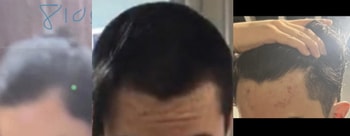 2018, 2020, 2023
