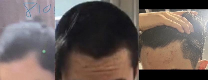 2018, 2020, 2023