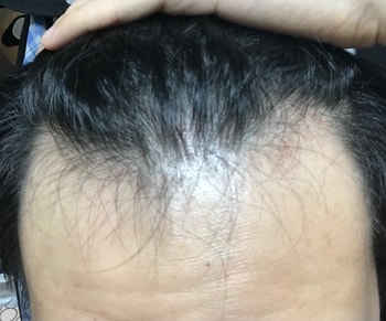 9/10 복용 156일차