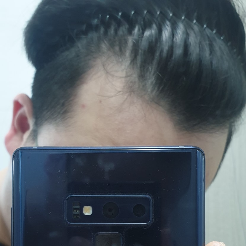 좌측 요즘 점점더 하얘짐