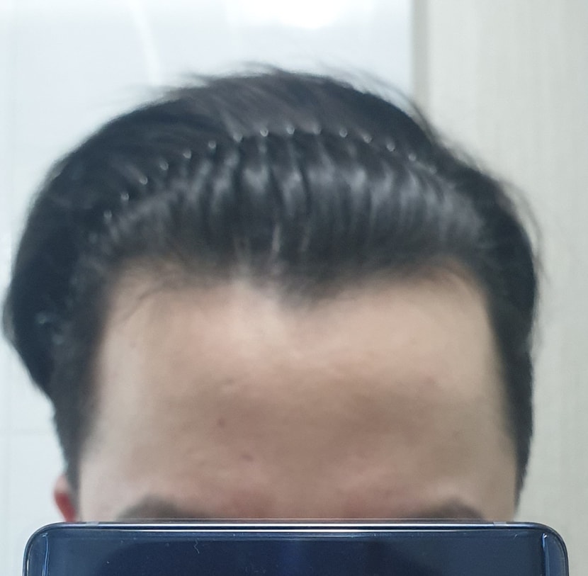 정면