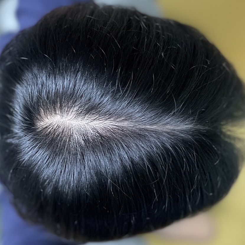 현재