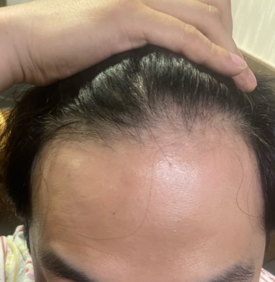 庆南梁山脱发圣地非常舒适