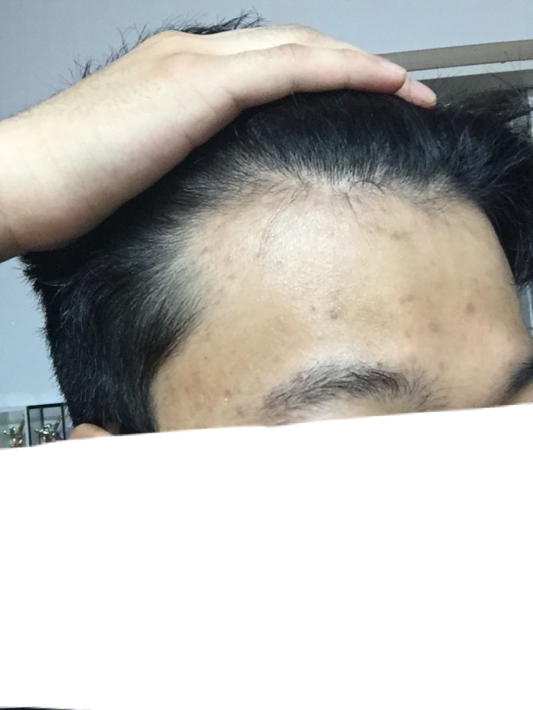 11/02