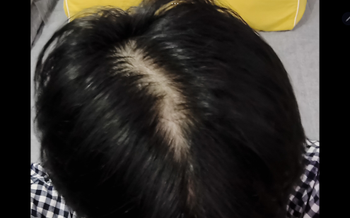 머리 감고 말렸을때