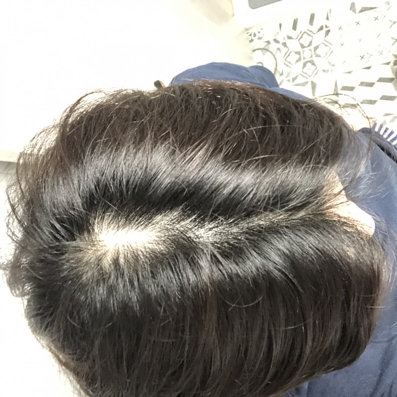 병원 가봐야겠죠?