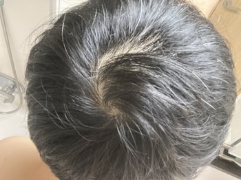 안 젖었을때 빛 아래