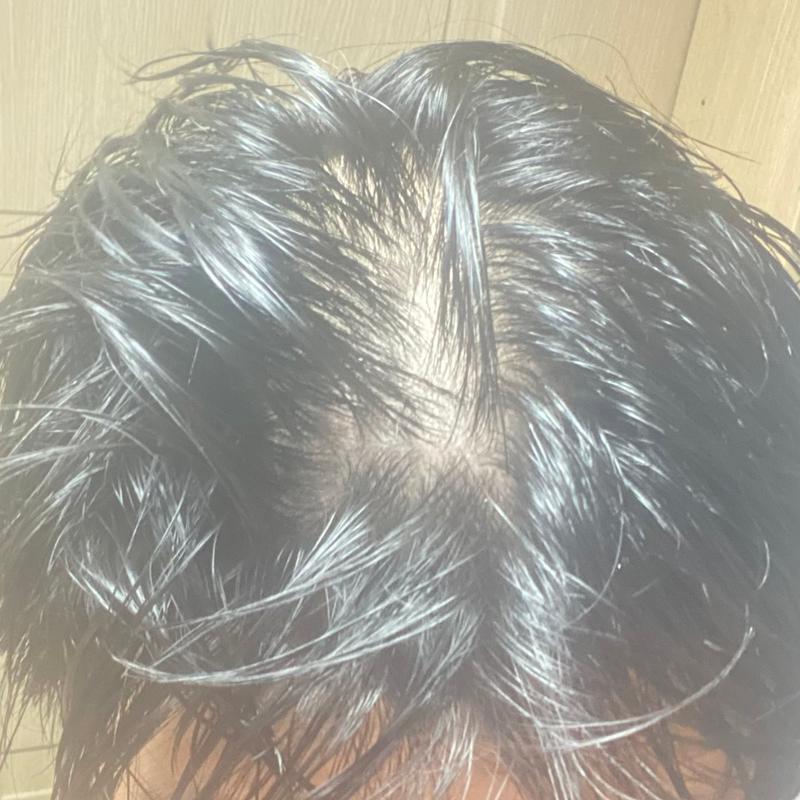 속알머리 맞죠..?