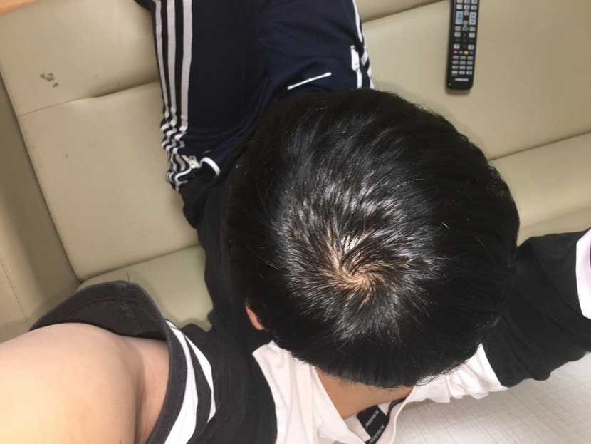 약 발랐을 때