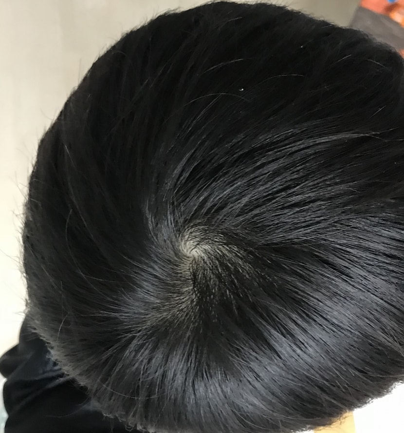 정수리