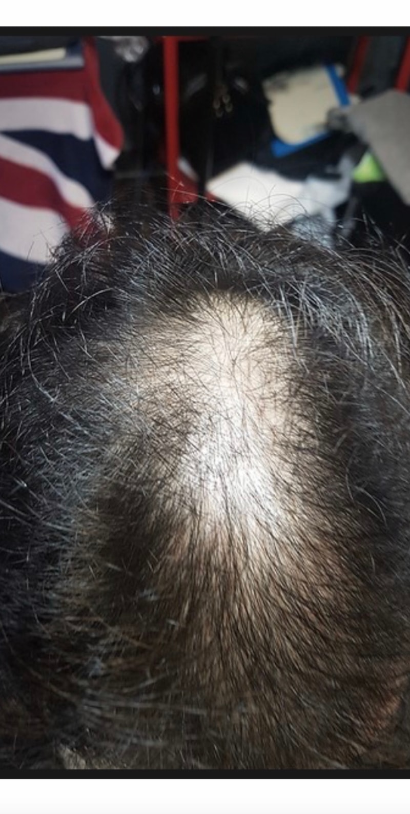 薬+未収録の17ヶ月はいかがですか？