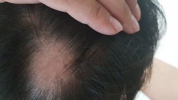 현재