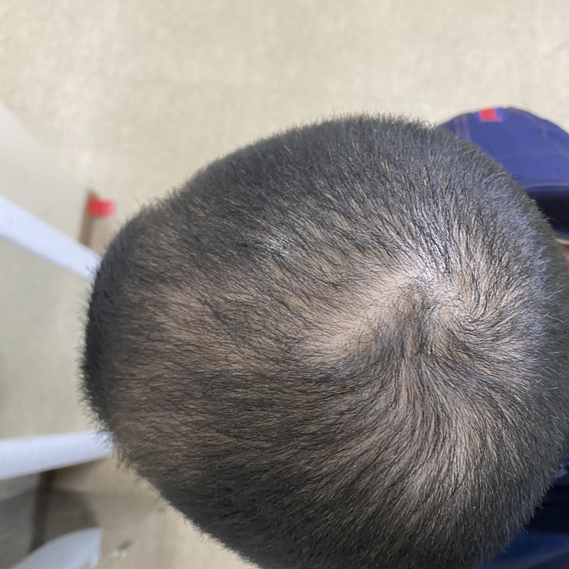 한달차 