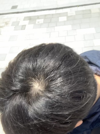 야외 자연광