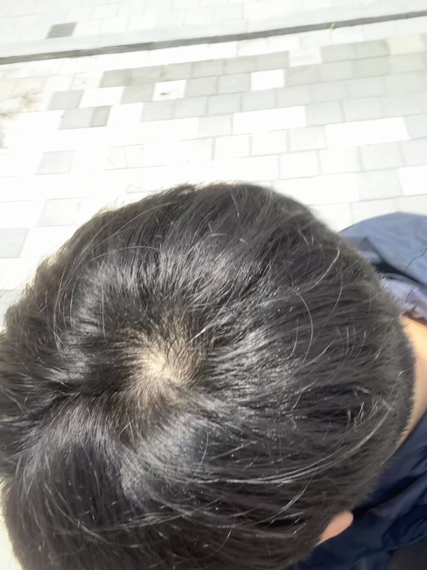 야외 자연광