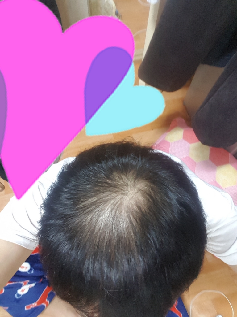 정수리사진